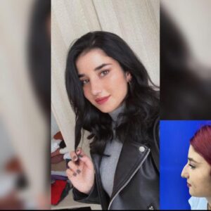 dr.mustafapolat_269368900_958530618414825_506372476359948081_n