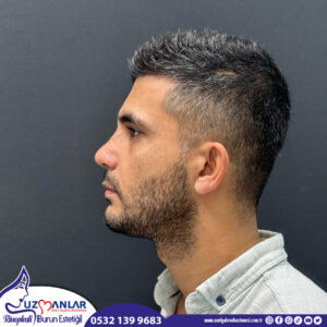 dr.mustafapolat_375656237_625632116383416_3644174012325789980_n